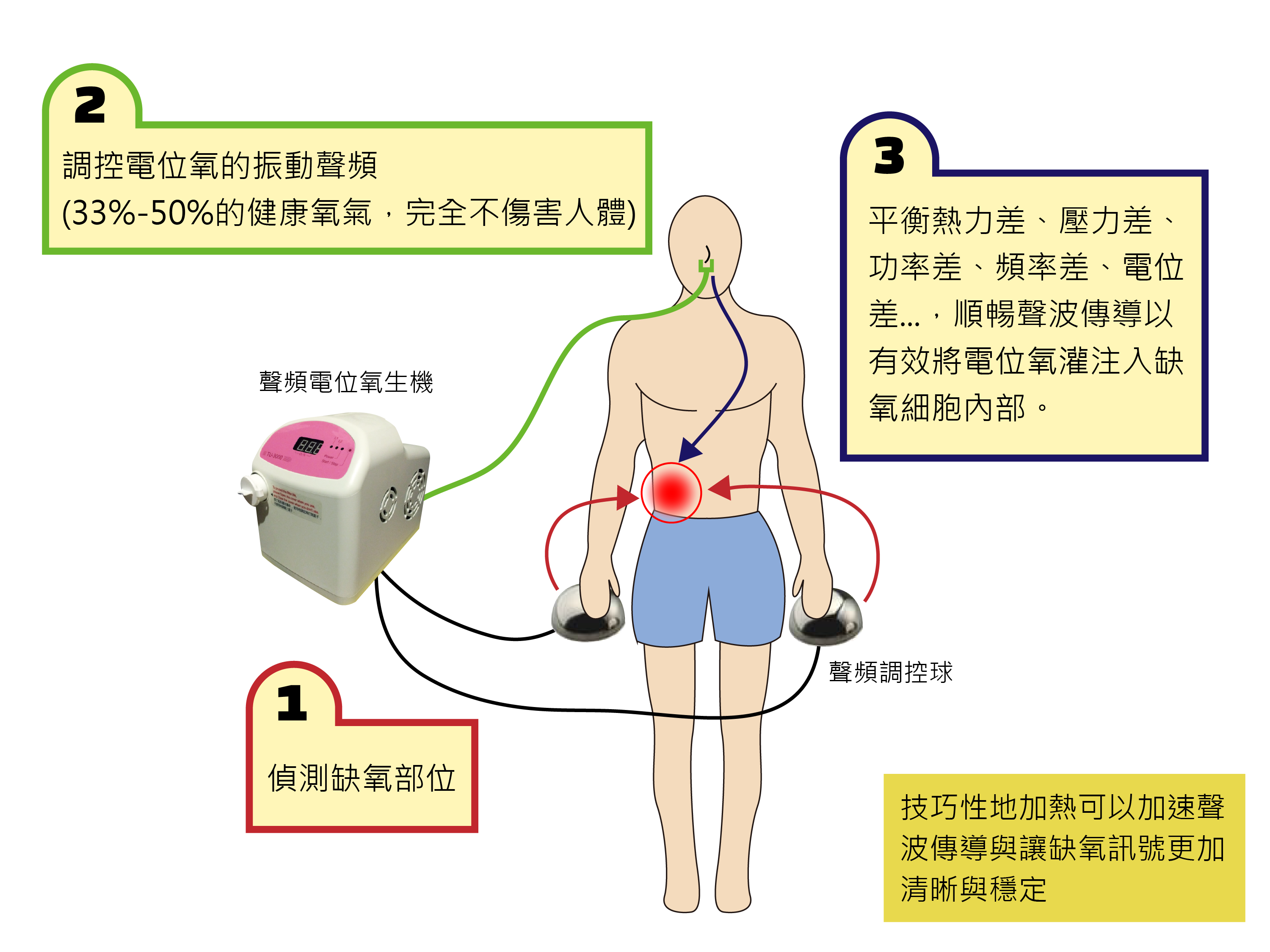 The working principles of TreatU Potential Oxygen System