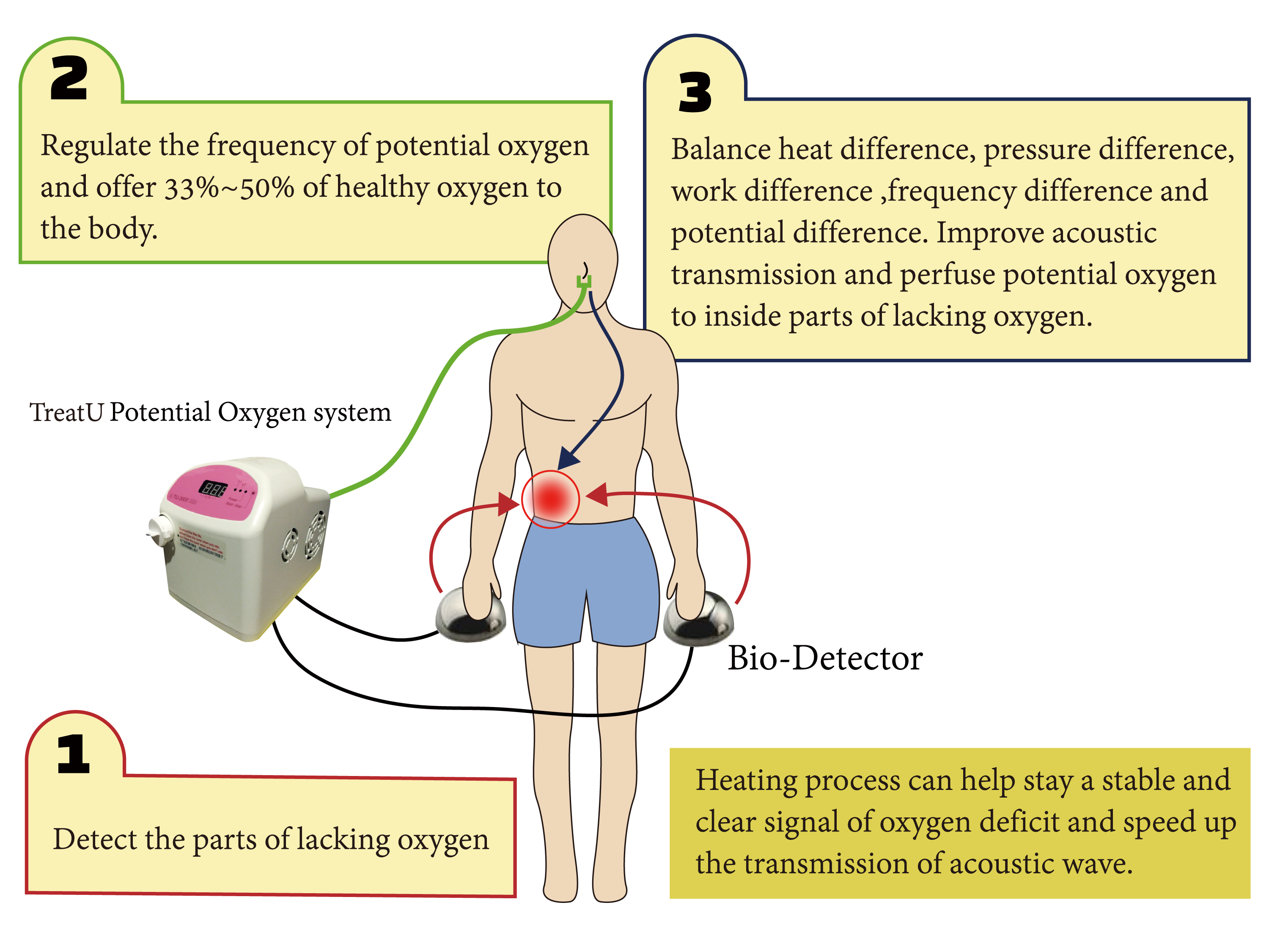 The working principles of TreatU Potential Oxygen System